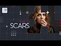 Download Lagu Tove Lo - Scars (Lyric Video)