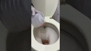 الدرنقه الجراحيه كيفيه الغيار عليها بخطوات بسيطه اكسبلور Dayinthelifeofanurse بيبي 