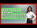 What Does A Brown Recluse Spider Bite Look Like - Survival Skills for Everyone