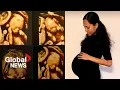 Incredible Identical quadruplets born in Australia