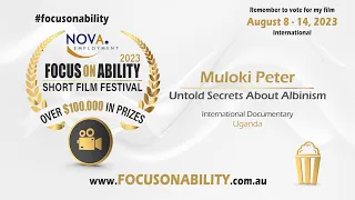Untold Secrets About Albinism film thumbnail