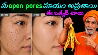 ఇది చూస్తే నిజంగా షాక్ అయిపోతారు😱 మీ open pores అన్ని ఒక్కసారికే మాయం అవుతాయి |Remove Open Pores 👍