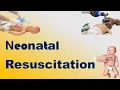 Neonatal Resuscitation TOACS OSCE Station
