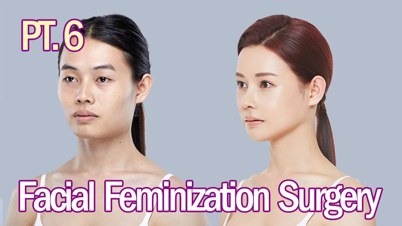 ▶Vava's Facial Feminization Surgery◀ EP 6. Q&A with the Plastic Surgeon at VIEW