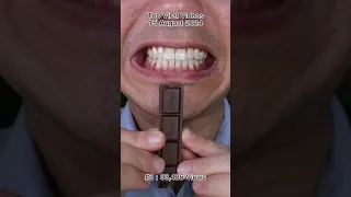 The Most Satisfying Chocolate & Candy ASMR Compilation