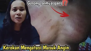 kerokan mengatasi masuk angin pilek dan batuk febrintanchanel6581