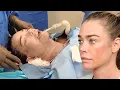 Inside Denise Richards Facelift Never-Before-Seen Footage From Shocking Transformation Exclusive