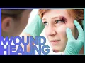 Phases of Wound Healing Explained - How a Cut Becomes a Scar Corporis
