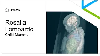 Rosalia Lombardo Child Mummy 2010