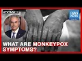What Are Monkeypox Symptoms Dr Zafar Mirza Spotlight Dawn News English