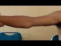 massage cidera bahu seorang atlit voli