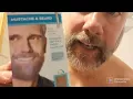 Just For Men Beard Dye Results