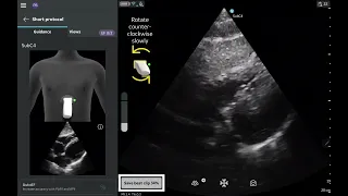 Vscan Air Product Tutorial Caption AI
