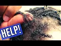 3 Ways to Repair Thinning Locs at the Roots BEST Loc Repair Methods