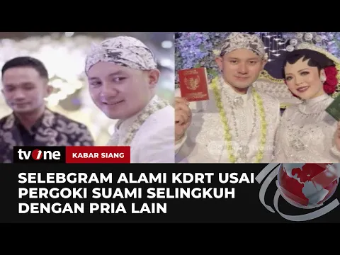 Selebgram Laporkan sang Suami ke Polisi atas Kasus KDRT dan Selingkuh dengan Pria Lain