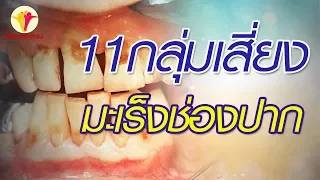 อะไรคือ 11 กลุ่มเสี่ยงที่ควรตรวจสุขภาพช่องปากปีละครั้ง เพื่อเฝ้าระวังมะเร็งช่องปาก