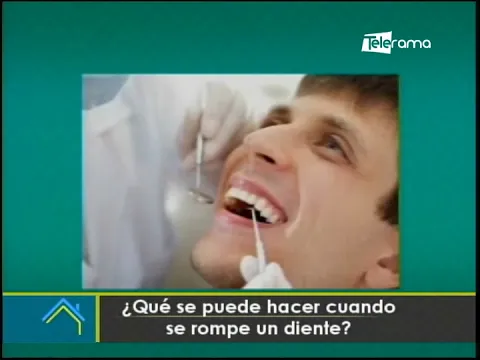 ¿Qué se puede hacer cuando se rompe un diente?