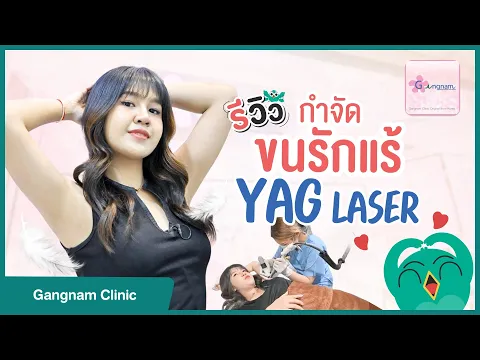 รีวิวเลเซอร์กำจัดขนรักแร้ โปรแกรม Long Pulse ND Yag ที่ Gangnam Clinic (กังนัมคลินิก)