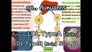  ทำไมการกินอาหารที่มีคาร์โบไฮเดรตและไขมันไม่ดีมากเกินไป ถึงทำให้ระดับไขมันในเลือดสูงขึ้น 