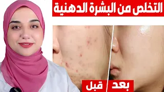 روتين للتخلص من كل مشاكل البشرة الدهنية و المختلطة افضل غسول و تونر و مرطب للبشرة الدهنية و المختلطة 