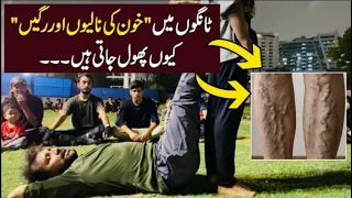 5 Best Exercises to Cure Varicose Veins | Tangon Ki Ragon Ka Ilaj Ghar mai