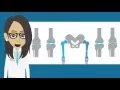 Top 20 Orthopedic ICD 9 to ICD 10 Codes