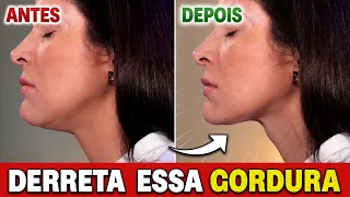 5 Minutos p/dia para REDUZIR PAPADA e Derreter a Gordura do Queixo!
