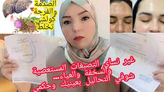 شكون كان يقول هدا الشوك كيصفي البشرة ويعالج الهالات والانتفاخ تحت العين وينقي الجسم من السموم‼️