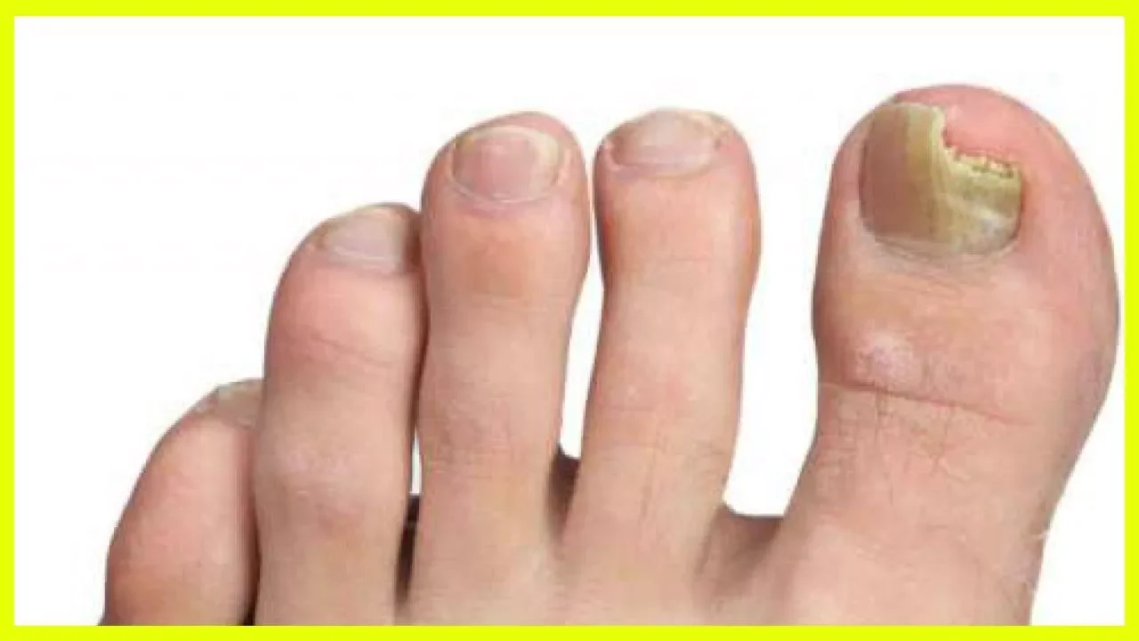 Kurkuma und Honig - Das stärkste Antibiotikum, das nicht einmal Ärzte erklären können!. 