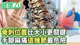 骨刺位置比大小更關鍵 手腳麻痛這幾節最危險【健康2.0分段】@tvbshealth20  EP3228-1 20260906 #陳欣湄#韋汝#江清泉#侯鐘堡#胡逸惟#鄒瑋倫#彥寬