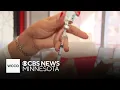 Medical s react to Trump s order on childhood vaccine recommendations
