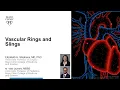 Download Lagu WEBINAR: Vascular Rings and Slings