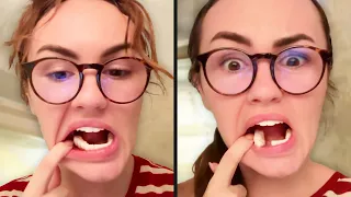 Teeth Aren't Supposed to Do This