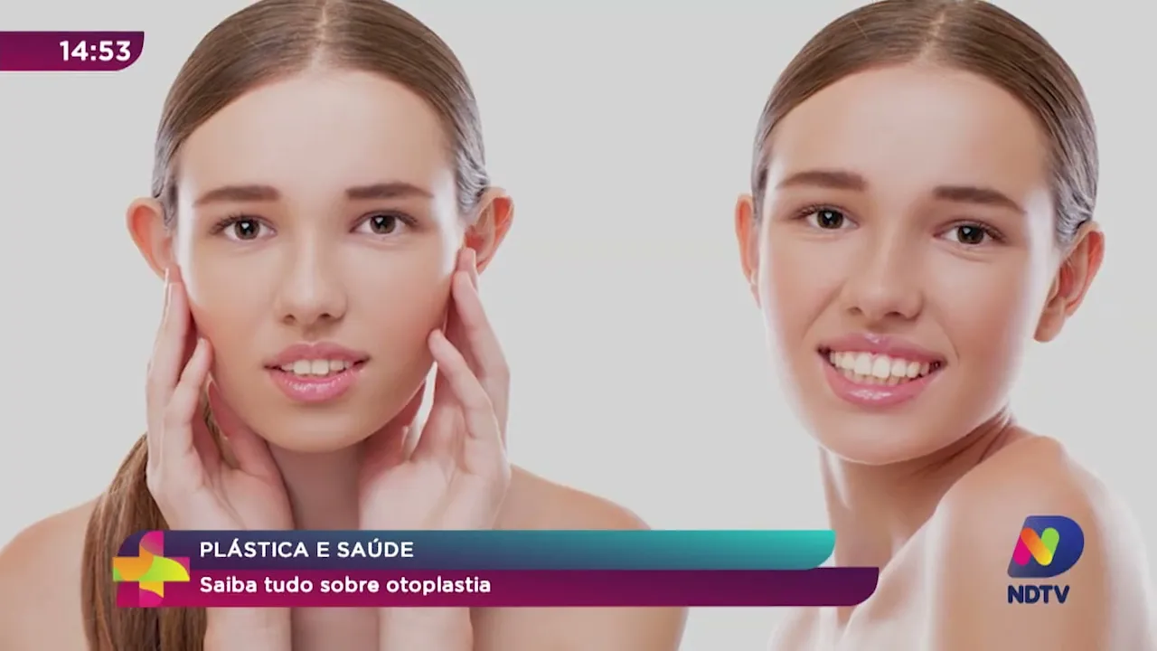 Plástica e saúde: saiba tudo sobre otoplastia