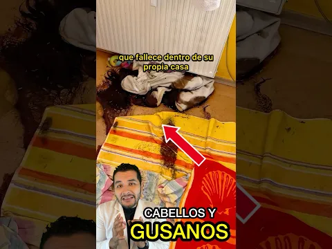 SE LE CAYÓ EL CABELLO 😱