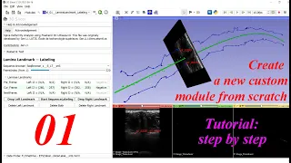 How to create a new custom module -