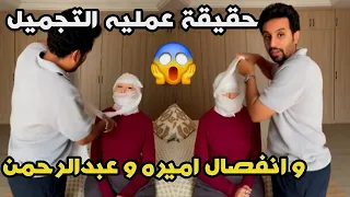 حقيقة عمليه التجميل و انفصال اميره و عبدالرحمن عائلة ميرو 