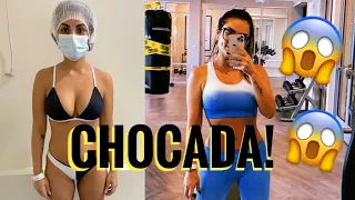 MINHA LIPO HD - PARTE 2 - ANTES E DEPOIS! | Thayane Lima