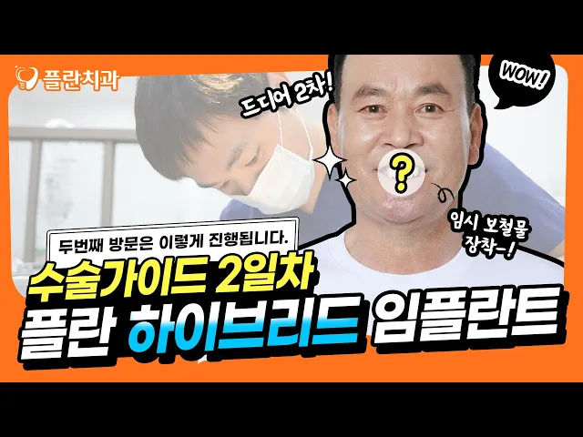 [서울치과] [플란 하이브리드 임플란트 수술가이드] "2일차" 수술 진행 과정!