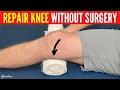 Download Lagu How to Heal and Repair Your Knee WITHOUT SURGERY