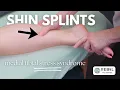 Massage for Shin Splints