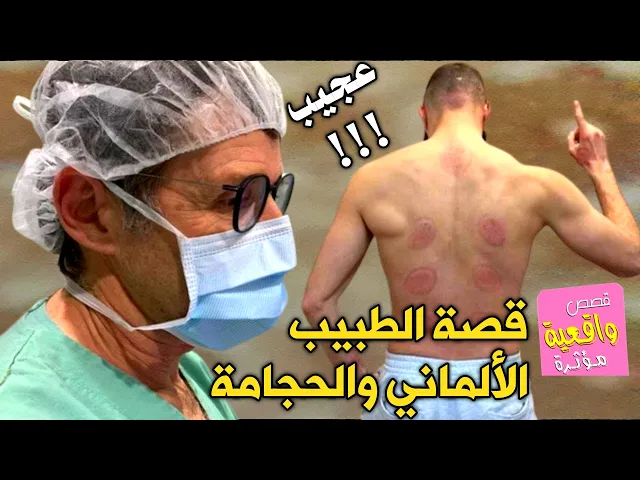 ⁣قصة الطبيب الألماني والحجامة - قصة مذهلة عجيب !! - قصص واقعية 8