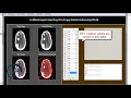 An Efficient Keypoint based Copy Move Forgery Detection Method using MATLAB