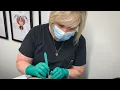 Hormone Replacement Therapy - Pellet Insertion Procedure