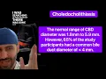 Choledocholithiasis