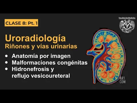 Download MP3 08.1 - Uroradiología - Anatomía por imagen y malformaciones congénitas