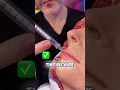 Download Lagu Don't inject the lips like this